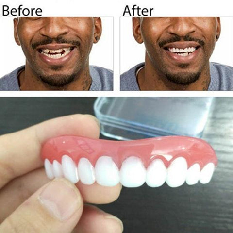 Image of Perfect Instant Smile
