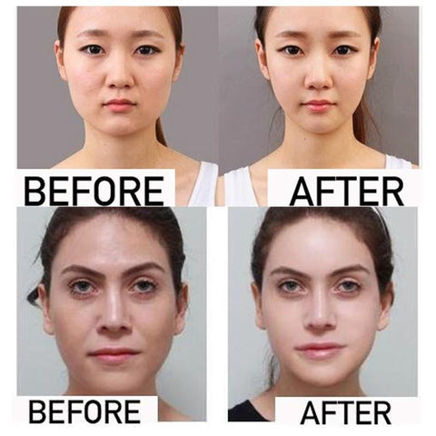 Image of Miracle V-Shaped Slimming Mask (4 Pieces/Set)