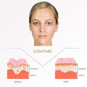 Miracle V-Shaped Slimming Mask (4 Pieces/Set)