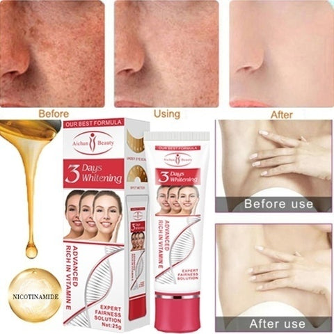 Image of Anti Aging Cream Women 3 Days Whitening Moisturizing Cream Skin Care Anti Freckle Lightening Cream Dark Spot Remover Face Care