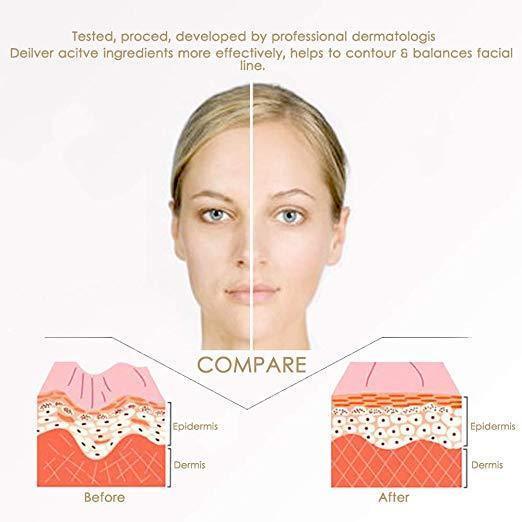 Miracle V-Shaped Slimming Mask (4 Pieces/Set)